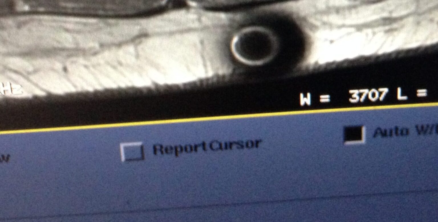 Unknown Object Appears in MRI