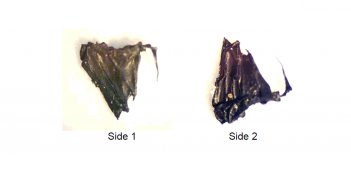 Analysis of a Suspected Alien Implant (March 11, 2006)