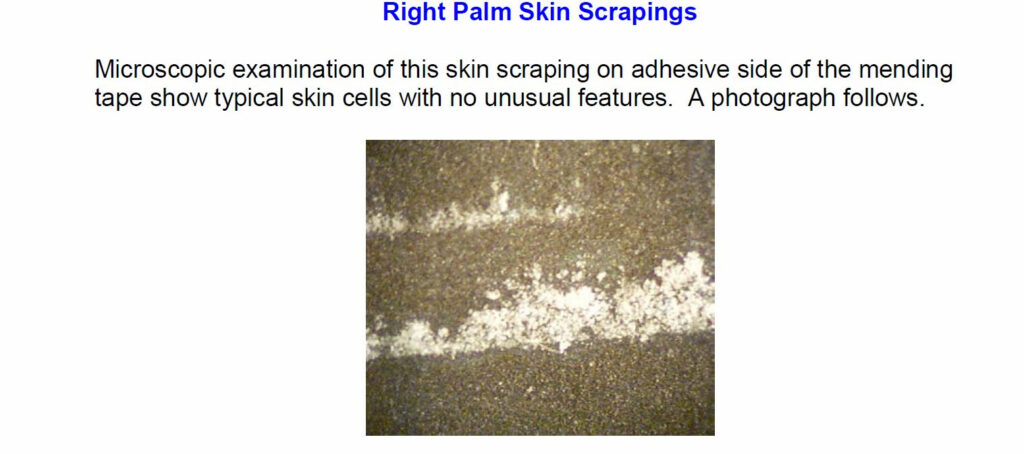 Analysis of Fluorescing Skin and Fingernails from a UFO Abduction Victim