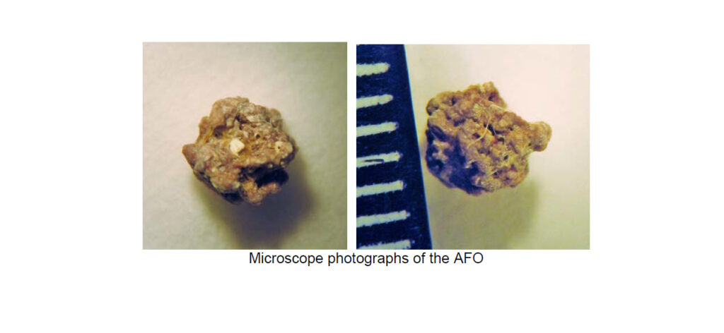 Analysis of an Anomalous Foreign Object (AFO) Expelled from the Throat of an Experiencer (July 24, 2014, Milwaukie, Oregon, CMS Case File: 58591)