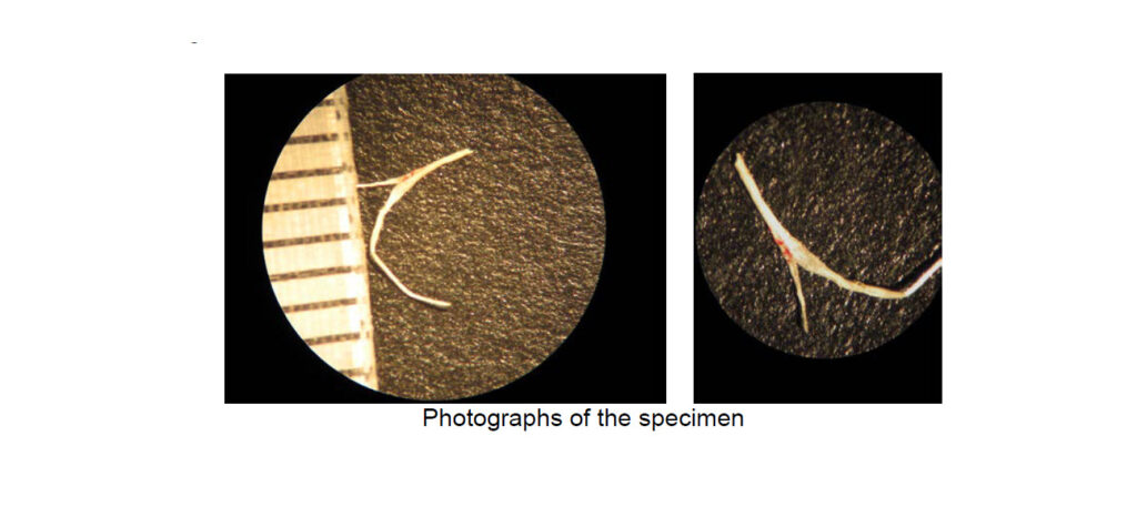 Analysis of a Fibrous Material Removed from an Experiencer’s Shoulder (August 15, 2015, Northwestern, Pennsylvania)